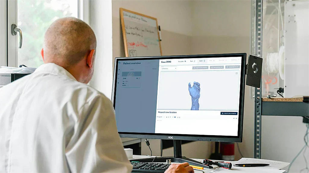 A technician reviews a 3D model of a hand on a computer for custom medical implant design and evaluation.